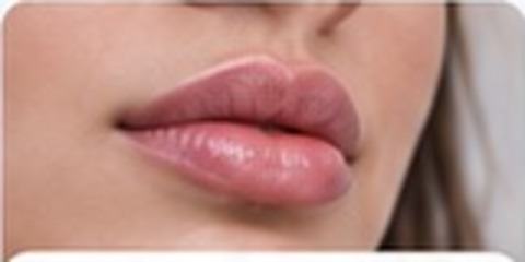 Relleno labial
