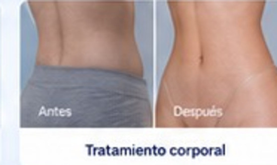 Antes y después de tratamiento corporal
